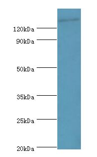 SPAG5 / MAP126 Antibody - Western blot. All lanes: SPAG5 antibody at 2 ug/ml. Secondary antibody: Goat polyclonal to rabbit at 1:10000 dilution. Predicted band size: 134 kDa. Observed band size: 134 kDa Immunohistochemistry.