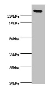 SPAG5 / MAP126 Antibody - Western blot All lanes: SPAG5 antibody at 2µg/ml Secondary Goat polyclonal to rabbit IgG at 1/10000 dilution Predicted band size: 134 kDa Observed band size: 134 kDa