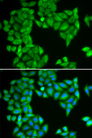 SPAG5 / MAP126 Antibody - Immunofluorescence analysis of HeLa cell using SPAG5 antibody. Blue: DAPI for nuclear staining.