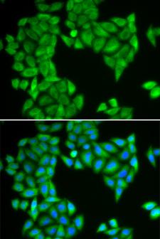 SPAG5 / MAP126 Antibody - Immunofluorescence analysis of HeLa cell using SPAG5 antibody. Blue: DAPI for nuclear staining.