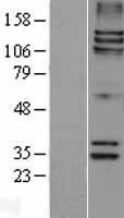 SPAG5 / MAP126 Protein - Western validation with an anti-DDK antibody * L: Control HEK293 lysate R: Over-expression lysate
