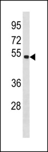 SPAG6 Antibody - SPAG6 Antibody western blot of MDA-MB453 cell line lysates (35 ug/lane). The SPAG6 antibody detected the SPAG6 protein (arrow).