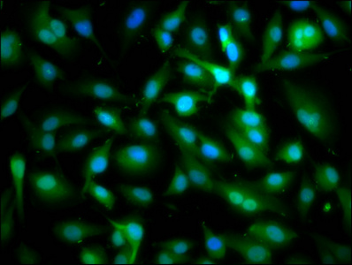 SPAG6 Antibody - Immunofluorescence staining of U251 cells diluted at 1:166, counter-stained with DAPI. The cells were fixed in 4% formaldehyde, permeabilized using 0.2% Triton X-100 and blocked in 10% normal Goat Serum. The cells were then incubated with the antibody overnight at 4°C.The Secondary antibody was Alexa Fluor 488-congugated AffiniPure Goat Anti-Rabbit IgG (H+L).