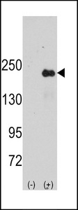 SPAG9 Antibody - Western blot of SPAG9 (arrow) using rabbit polyclonal SPAG9 Antibody. 293 cell lysates (2 ug/lane) either nontransfected (Lane 1) or transiently transfected with the SPAG9 gene (Lane 2) (Origene Technologies).