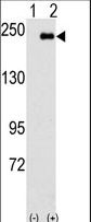 SPAG9 Antibody - Western blot of SPAG9(arrow) using rabbit polyclonal SPAG9 Antibody. 293 cell lysates (2 ug/lane) either nontransfected (Lane 1) or transiently transfected with the SPAG9 gene (Lane 2) (Origene Technologies).