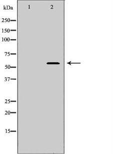 SPAM1 / PH20 Antibody - Western blot analysis of extracts of PC-3 using SPAM antibody. The lane on the left is treated with the antigen-specific peptide.