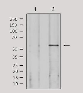 SPAM1 / PH20 Antibody - Western blot analysis of extracts of 293 cells using SPAM1 antibody. Lane 1 was treated with the antigen-specific peptide.