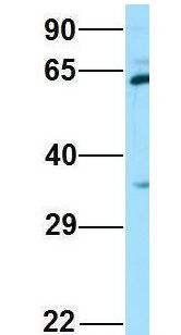 SPAM1 / PH20 Antibody - SPAM1 / PH20 antibody Western Blot of 293T lysate. Antibody Dilution: 1.0 ug/ml. Antibody dilution: 1 ug/ml.  This image was taken for the unconjugated form of this product. Other forms have not been tested.