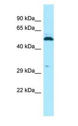 SPAM1 / PH20 Antibody - SPAM1 / PH20 antibody Western Blot of Jurkat.  This image was taken for the unconjugated form of this product. Other forms have not been tested.