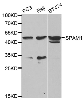 SPAM1 / PH20 Antibody - Western blot analysis of extracts of various cell lines.