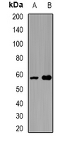 SPAM1 / PH20 Antibody - Western blot analysis of SPAM1 expression in PC3 (A); Raji (B) whole cell lysates.