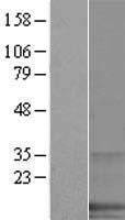 SPANXA1 Protein - Western validation with an anti-DDK antibody * L: Control HEK293 lysate R: Over-expression lysate