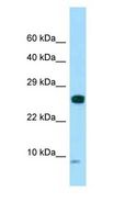 SPANXC / SPANX-C Antibody - SPANXC / SPANX-C antibody Western Blot of HeLa.  This image was taken for the unconjugated form of this product. Other forms have not been tested.