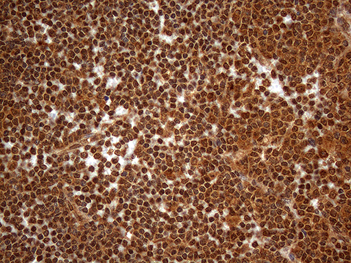 SPANXN3 Antibody - Immunohistochemical staining of paraffin-embedded Human lymph node tissue within the normal limits using anti-SPANXN3 mouse monoclonal antibody. (Heat-induced epitope retrieval by 1mM EDTA in 10mM Tris buffer. (pH8.5) at 120°C for 3 min. (1:2000)