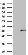 SPANXN3 Antibody - HEK293T cells were transfected with the pCMV6-ENTRY control. (Left lane) or pCMV6-ENTRY SPANXN3. (Right lane) cDNA for 48 hrs and lysed. Equivalent amounts of cell lysates. (5 ug per lane) were separated by SDS-PAGE and immunoblotted with anti-SPANXN3. (1:500)