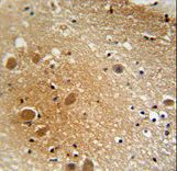 SPARCL1 / Hevin Antibody - SPARCL1 antibody immunohistochemistry of formalin-fixed and paraffin-embedded human brain tissue followed by peroxidase-conjugated secondary antibody and DAB staining.