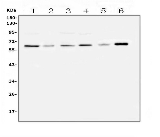 SPARCL1 / Hevin Antibody - Western blot analysis of SPARCL1 using anti-SPARCL1 antibody. Electrophoresis was performed on a 5-20% SDS-PAGE gel at 70V (Stacking gel) / 90V (Resolving gel) for 2-3 hours. The sample well of each lane was loaded with 50ug of sample under reducing conditions. Lane 1: human U-87MG whole cell lysates,Lane 2: human SHG-44 whole cell lysates,Lane 3: human MDA-MB-231 whole cell lysates,Lane 4: human K562 whole cell lysates,Lane 5: rat C6 whole cell lysates,Lane 6: mouse smooth muscle tissue lysates. After Electrophoresis, proteins were transferred to a Nitrocellulose membrane at 150mA for 50-90 minutes. Blocked the membrane with 5% Non-fat Milk/ TBS for 1.5 hour at RT. The membrane was incubated with rabbit anti-SPARCL1 antigen affinity purified polyclonal antibody at 0.5mg/mL overnight at 4?C, then washed with TBS-0.1% Tween 3 times with 5 minutes each and probed with a goat anti-rabbit IgG-HRP secondary antibody at a dilution of 1:10000 for 1.5 hour at RT. The signal is developed using an Enhanced Chemiluminescent detection (ECL) kit with Tanon 5200 system. A specific band was detected for SPARCL1 at approximately 62KD. The expected band size for SPARCL1 is at 75KD.