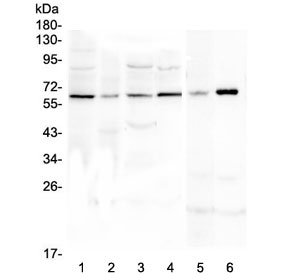 SPARCL1 / Hevin Antibody - Western blot testing of human 1) U-87 MG, 2) SHG-44, 3) MDA-MB-231, 4) k562, 5) rat C6 and 7) mouse smooth muscle (intestine) lysate. Predicted molecular weight ~75 kDa, observed here at ~62 kDa.