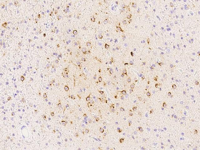 SPARCL1 / Hevin Antibody - Immunochemical staining of human SPARCL1 in human brain with rabbit polyclonal antibody at 1:500 dilution, formalin-fixed paraffin embedded sections.