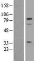 SPARCL1 / Hevin Protein - Western validation with an anti-DDK antibody * L: Control HEK293 lysate R: Over-expression lysate