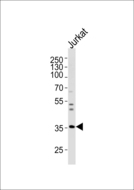 Spastic / GLRB Antibody - Western blot of lysate from Jurkat cell line, using GLRB Antibody. Antibody was diluted at 1:1000 at each lane. A goat anti-rabbit IgG H&L (HRP) at 1:5000 dilution was used as the secondary antibody. Lysate at 35ug per lane.