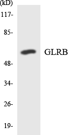Spastic / GLRB Antibody - Western blot analysis of the lysates from HUVECcells using GLRB antibody.