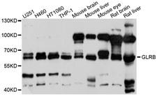 Spastic / GLRB Antibody - Western blot analysis of extracts of various cell lines, using GLRB antibody at 1:1000 dilution. The secondary antibody used was an HRP Goat Anti-Rabbit IgG (H+L) at 1:10000 dilution. Lysates were loaded 25ug per lane and 3% nonfat dry milk in TBST was used for blocking. An ECL Kit was used for detection and the exposure time was 10s.