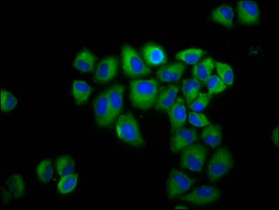 Spastic / GLRB Antibody - Immunofluorescence staining of Hela cells diluted at 1:200, counter-stained with DAPI. The cells were fixed in 4% formaldehyde, permeabilized using 0.2% Triton X-100 and blocked in 10% normal Goat Serum. The cells were then incubated with the antibody overnight at 4°C.The Secondary antibody was Alexa Fluor 488-congugated AffiniPure Goat Anti-Rabbit IgG (H+L).
