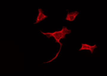 Spastic / GLRB Antibody - Staining HeLa cells by IF/ICC. The samples were fixed with PFA and permeabilized in 0.1% Triton X-100, then blocked in 10% serum for 45 min at 25°C. The primary antibody was diluted at 1:200 and incubated with the sample for 1 hour at 37°C. An Alexa Fluor 594 conjugated goat anti-rabbit IgG (H+L) Ab, diluted at 1/600, was used as the secondary antibody.