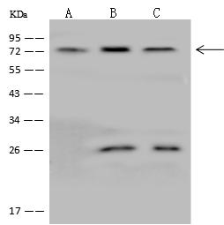Spastic / GLRB Antibody - Anti-GLRB rabbit polyclonal antibody at 1:500 dilution. Lane A: K562 Whole Cell Lysate. Lane B: Jurkat Whole Cell Lysate. Lane C: U-251 MG Whole Cell Lysate. Lysates/proteins at 30 ug per lane. Secondary: Goat Anti-Rabbit IgG (H+L)/HRP at 1/10000 dilution. Developed using the ECL technique. Performed under reducing conditions. Predicted band size: 56 kDa. Observed band size: 72 kDa.