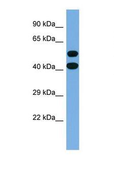 Spastin Antibody - Western blot of Human MCF7. SPAST antibody dilution 1.0 ug/ml.  This image was taken for the unconjugated form of this product. Other forms have not been tested.