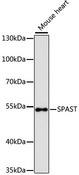 Spastin Antibody - Western blot analysis of extracts of mouse heart using SPAST Polyclonal Antibody at dilution of 1:3000.