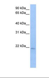 SPATA12 Antibody - Jurkat cell lysate. Antibody concentration: 0.5 ug/ml. Gel concentration: 12%.  This image was taken for the unconjugated form of this product. Other forms have not been tested.