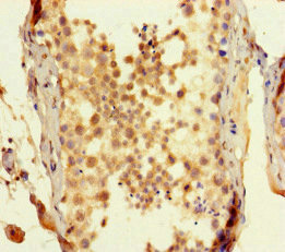 SPATA16 / NYD-SP12 Antibody - Immunohistochemistry of paraffin-embedded human testis tissue at dilution of 1:100