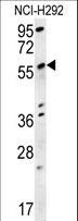 SPATA18 / MIEAP Antibody - SPATA18 Antibody western blot of NCI-H292 cell line lysates (15 ug/lane). The SPATA18 antibody detected SPATA18 protein (arrow).