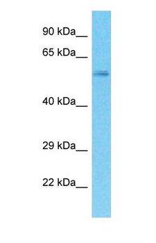 SPATA18 / MIEAP Antibody - Western blot of SPATA18 Antibody with human Stomach Tumor lysate.  This image was taken for the unconjugated form of this product. Other forms have not been tested.