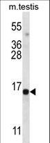 SPATA19 Antibody - SPT19 Antibody western blot of mouse testis tissue lysates (35 ug/lane). The SPT19 antibody detected the SPT19 protein (arrow).