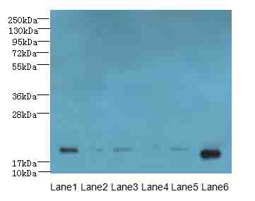 SPATA19 Antibody - Western blot. All lanes: SPATA19 antibody at 1 ug/ml. Lane 1: MCF7 whole cell lysate. Lane 2: HeLa whole cell lysate. Lane 3: HepG-2 whole cell lysate. Lane 4: MDA-MB-231 whole cell lysate. Lane 5: A549 whole cell lysate. Lane 6: Mouse liver tissue. Secondary Goat polyclonal to Rabbit IgG at 1:10000 dilution. Predicted band size: 19 kDa. Observed band size: 19 kDa.