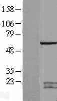 SPATA2 Protein - Western validation with an anti-DDK antibody * L: Control HEK293 lysate R: Over-expression lysate