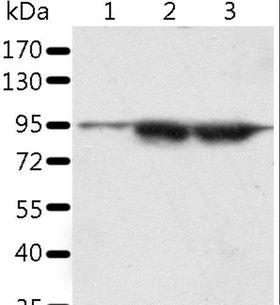 SPATA20 Antibody - Western blot analysis of A549 and LNCaP cell, human seminoma tissue, using SPATA20 Polyclonal Antibody at dilution of 1:1000.
