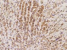 SPATA20 Antibody - Immunochemical staining of human SPATA20 in human adrenal gland with rabbit polyclonal antibody at 1:100 dilution, formalin-fixed paraffin embedded sections.
