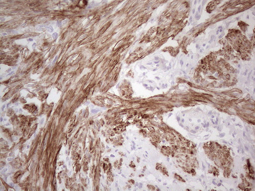 SPATA22 Antibody - Immunohistochemical staining of paraffin-embedded Human endometrium tissue within the normal limits using anti-SPATA22 mouse monoclonal antibody. (Heat-induced epitope retrieval by 1mM EDTA in 10mM Tris buffer. (pH8.5) at 120°C for 3 min. (1:150).