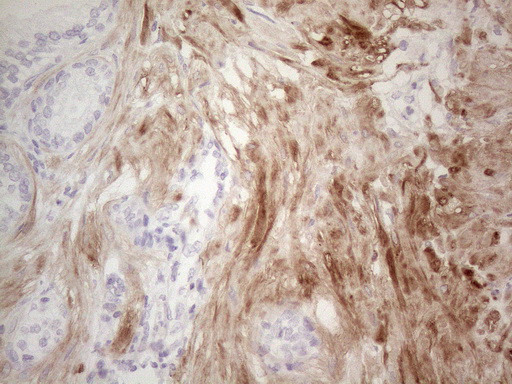 SPATA22 Antibody - Immunohistochemical staining of paraffin-embedded Human prostate tissue within the normal limits using anti-SPATA22 mouse monoclonal antibody. (Heat-induced epitope retrieval by 1mM EDTA in 10mM Tris buffer. (pH8.5) at 120°C for 3 min. (1:150)