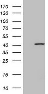 SPATA22 Antibody - HEK293T cells were transfected with the pCMV6-ENTRY control. (Left lane) or pCMV6-ENTRY SPATA22. (Right lane) cDNA for 48 hrs and lysed. Equivalent amounts of cell lysates. (5 ug per lane) were separated by SDS-PAGE and immunoblotted with anti-SPATA22. (1:500)
