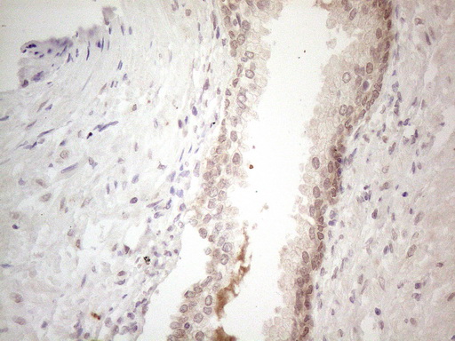 SPATA22 Antibody - Immunohistochemical staining of paraffin-embedded Human prostate tissue within the normal limits using anti-SPATA22 mouse monoclonal antibody. (Heat-induced epitope retrieval by 1mM EDTA in 10mM Tris buffer. (pH8.5) at 120°C for 3 min. (1:150)