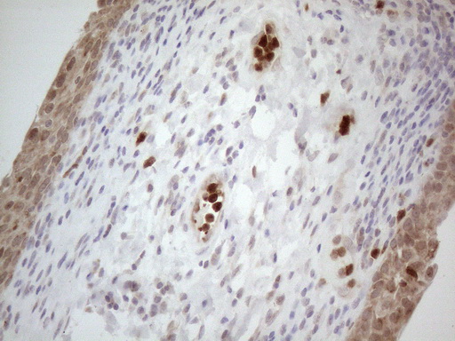 SPATA22 Antibody - Immunohistochemical staining of paraffin-embedded Human bladder tissue within the normal limits using anti-SPATA22 mouse monoclonal antibody. (Heat-induced epitope retrieval by 1mM EDTA in 10mM Tris buffer. (pH8.5) at 120°C for 3 min. (1:150)