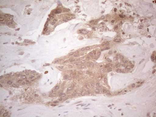 SPATA22 Antibody - Immunohistochemical staining of paraffin-embedded Human liver tissue within the normal limits using anti-SPATA22 mouse monoclonal antibody. (Heat-induced epitope retrieval by 1mM EDTA in 10mM Tris buffer. (pH8.5) at 120°C for 3 min. (1:150)