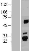 SPATA24 Protein - Western validation with an anti-DDK antibody * L: Control HEK293 lysate R: Over-expression lysate