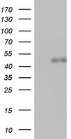 SPATA2L Antibody - HEK293T cells were transfected with the pCMV6-ENTRY control (Left lane) or pCMV6-ENTRY SPATA2L (Right lane) cDNA for 48 hrs and lysed. Equivalent amounts of cell lysates (5 ug per lane) were separated by SDS-PAGE and immunoblotted with anti-SPATA2L.