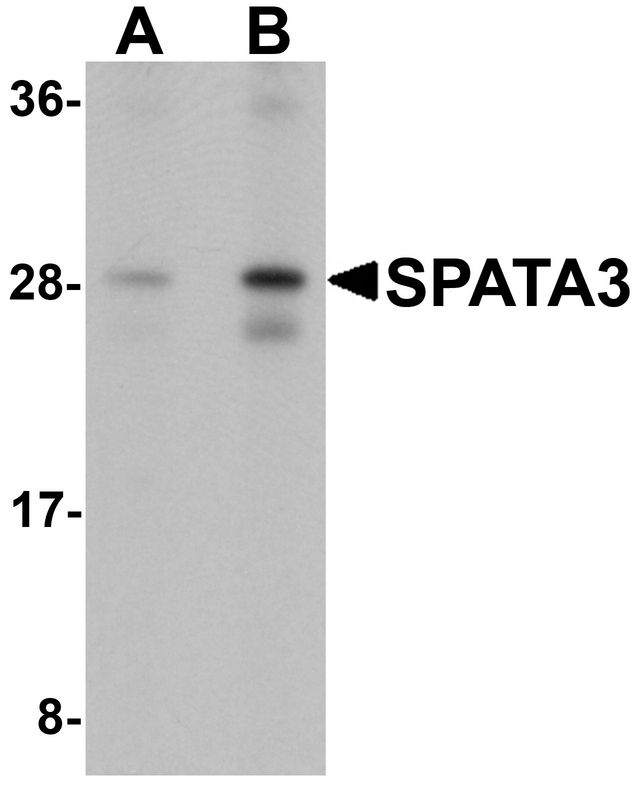 SPATA3 / ASARG1 Antibody - Western blot analysis of SPATA3 in mouse lung tissue lysate with SPATA3 antibody at (A) 1 and (B) 2 ug/ml.
